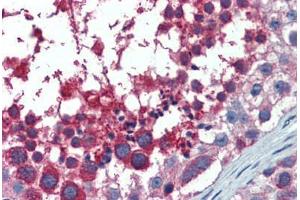 Human Testis: Formalin-Fixed, Paraffin-Embedded (FFPE) (USO1 anticorps  (AA 1-962))