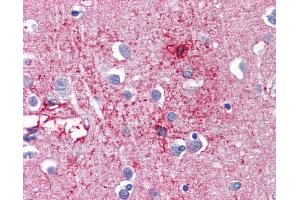 Anti-CDH18 antibody IHC of human brain, cortex.