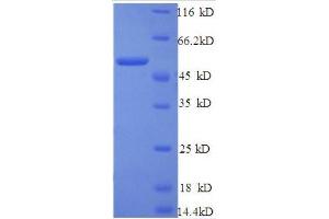 Cathepsin B (CTSB) (AA 82-333), (partial) protein (GST tag) (Cathepsin B Protein (CTSB) (AA 82-333, partial) (GST tag))