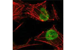 Confocal immunofluorescence analysis of HeLa cells using MSH2 monoclonal antibody, clone 1B3 (3A2B8C)  (green), showing nuclear localization.