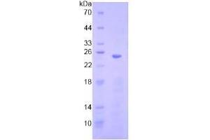 SDS-PAGE analysis of Human HMG1 Protein. (HMGB1 Protéine)