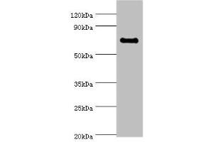 Western blot All lanes: TAF5L antibody at 10 μg/mL + Jurkat whole cell lysate Secondary Goat polyclonal to rabbit IgG at 1/10000 dilution Predicted band size: 67, 37 kDa Observed band size: 67 kDa