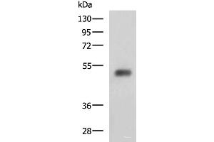 Western blot analysis of Human bladder transitional cell carcinoma grade 2-3 tissue lysate using SLC30A6 Polyclonal Antibody at dilution of 1:2000 (SLC30A6 anticorps)