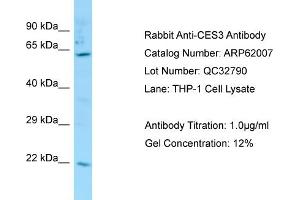 Western Blotting (WB) image for anti-Carboxylesterase 3 (CES3) (Middle Region) antibody (ABIN2788985)