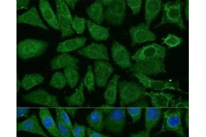 Immunofluorescence analysis of L929 cells using NDUFB4 Polyclonal Antibody at dilution of 1:100 (40x lens). (NDUFB4 anticorps)