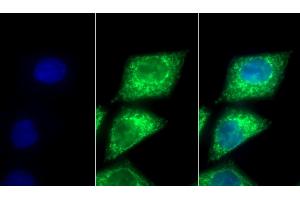 Detection of PDHA1 in Human HepG2 cell using Polyclonal Antibody to Pyruvate dehydrogenase alpha 1 (PDHA1) (PDHA1 anticorps  (AA 30-390))