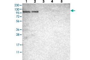 Western blot analysis of Lane 1: RT-4, Lane 2: U-251 MG, Lane 3: Human Plasma, Lane 4: Liver, Lane 5: Tonsil with SGEF polyclonal antibody .