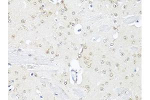 Immunohistochemistry of paraffin-embedded mouse brain using RBFOX3 antibody (ABIN1874561) at dilution of 1:100 (40x lens). (NeuN anticorps)