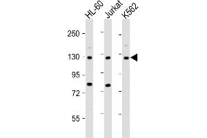 All lanes : Anti-ATP2A3 Antibody (N-Term) at 1:2000 dilution Lane 1: HL-60 whole cell lysate Lane 2: Jurkat whole cell lysate Lane 3: K562 whole cell lysate Lysates/proteins at 20 μg per lane.