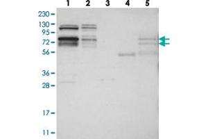 Western blot analysis of Lane 1: RT-4, Lane 2: U-251 MG, Lane 3: Human Plasma, Lane 4: Liver, Lane 5: Tonsil with RBM28 polyclonal antibody  at 1:250-1:500 dilution. (RBM28 anticorps)