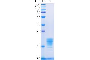 Human IL5 Protein, His Tag on SDS-PAGE under reducing condition.