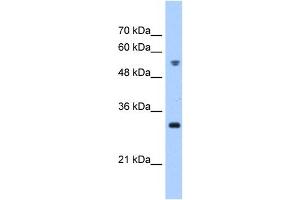 TTC5 antibody used at 0. (TTC5 anticorps  (C-Term))