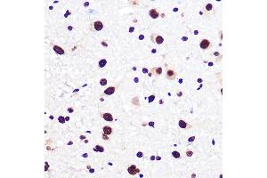 Immunohistochemistry of paraffin-embedded rat brain using KHDRBS1/KHDRBS1/Sam68 Rabbit mAb (ABIN1680037, ABIN3018237, ABIN3018238 and ABIN7101585) at dilution of 1:100 (40x lens).