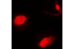 Immunofluorescent analysis of SUFU staining in MCF7 cells. (SUFUH anticorps)