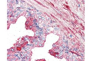 Anti-GPR27 antibody IHC of human prostate. (GPR27 anticorps  (Internal Region))
