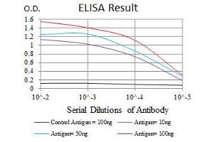 Black line: Control Antigen (100 ng), Purple line: Antigen(10 ng), Blue line: Antigen (50 ng), Red line: Antigen (100 ng), (Cytokeratin 5 anticorps  (AA 316-590))
