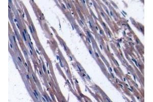 IHC-P analysis of Rat Cardiac Muscle Tissue, with DAB staining.