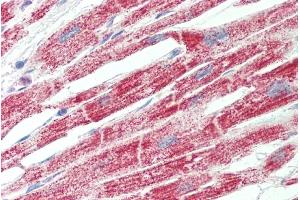 ABIN2613392 (5µg/ml) staining of paraffin embedded Human Heart.