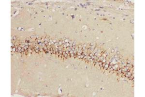 Anti-5HT1A Receptor antibody, IHC(P): Rat Brain Tissue (Serotonin Receptor 1A anticorps  (C-Term))