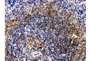 Immunohistochemistry (Paraffin-embedded Sections) (IHC (p)) image for anti-Actin, alpha 1, Skeletal Muscle (ACTA1) (AA 277-308), (C-Term) antibody (ABIN3043519)