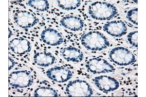 Image no. 5 for anti-Mitogen-Activated Protein Kinase Kinase 4 (MAP2K4) antibody (ABIN1499481)