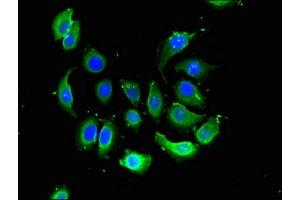 Immunofluorescent analysis of A549 cells using ABIN7175192 at dilution of 1:100 and Alexa Fluor 488-congugated AffiniPure Goat Anti-Rabbit IgG(H+L)