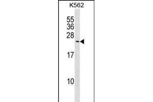 MYL6B Antibody (Center) (ABIN1538709 and ABIN2850105) western blot analysis in K562 cell line lysates (35 μg/lane).