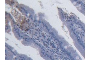 Detection of IL15 in Rat Small intestine Tissue using Monoclonal Antibody to Interleukin 15 (IL15) (IL-15 anticorps  (AA 49-162))