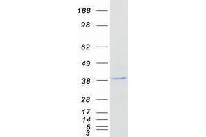 Validation with Western Blot
