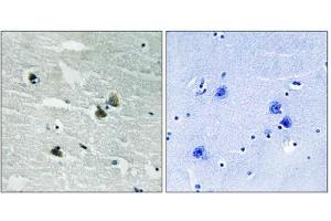 Immunohistochemistry analysis of paraffin-embedded human brain tissue using MER/SKY (Phospho-Tyr749/681) antibody. (MER/SKY (pTyr681), (pTyr749) anticorps)