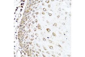 Immunohistochemistry of paraffin-embedded human esophagus using RAC2 antibody at dilution of 1:100 (40x lens).