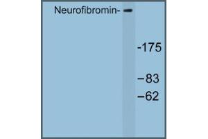Image no. 1 for anti-Neurofibromin 1 (NF1) antibody (ABIN317682) (Neurofibromin 1 anticorps)