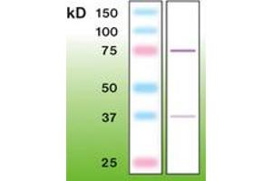 Image no. 1 for anti-Protein Kinase C, beta (PRKCB) antibody (ABIN6756685) (PKC beta anticorps)
