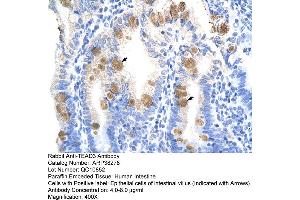 Human Intestine (TEAD3 anticorps  (C-Term))