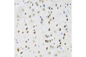 Immunohistochemistry of paraffin-embedded mouse brain using PPP1CA antibody.