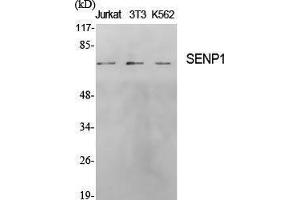 Western Blotting (WB) image for anti-SUMO1/sentrin Specific Peptidase 1 (SENP1) (N-Term) antibody (ABIN3186898) (SENP1 anticorps  (N-Term))