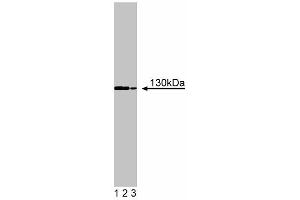 Western blot analysis of FYB on a Jurkat cell lysate (Human T-cell leukemia, ATCC TIB-152) . (FYB anticorps  (AA 673-783))
