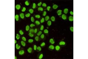Immunofluorescent analysis of Hela cells using Ku80 mouse mAb (1:400). (XRCC5 anticorps)