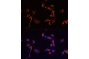 Immunofluorescence analysis of  cells using c-Abl antibody (ABIN3020871, ABIN3020872, ABIN3020873 and ABIN6213767) at dilution of 1:100 (40x lens).