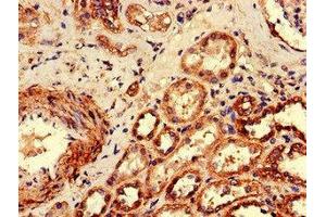 Immunohistochemistry of paraffin-embedded human kidney tissue using ABIN7174788 at dilution of 1:100 (C1ORF189 anticorps  (AA 1-101))