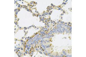 Immunohistochemistry of paraffin-embedded rat lung using UBE2B Antibody (ABIN5973734) at dilution of 1/100 (40x lens). (UBE2B anticorps)