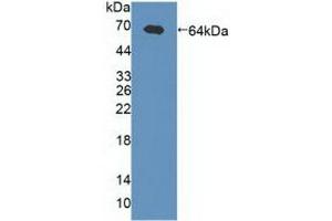 Figure. (GABRA2 anticorps  (AA 42-250))