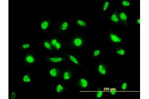 Immunofluorescence of monoclonal antibody to MAP2K6 on HeLa cell.