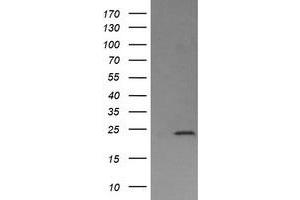 Image no. 3 for anti-Deleted in Primary Ciliary Dyskinesia Homolog (DPCD) antibody (ABIN1497889) (DPCD anticorps)