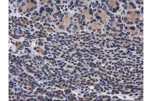 Image no. 16 for anti-Destrin (Actin Depolymerizing Factor) (DSTN) antibody (ABIN1497910) (Destrin anticorps)