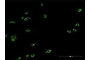 Immunofluorescence of monoclonal antibody to LHX4 on HeLa cell.