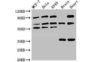 Western Blot Positive WB detected in: MCF-7 whole cell lysate, Hela whole cell lysate, A549 whole cell lysate, Rat brain tissue, Rat heart tissue All lanes: TRIM4 antibody at 3. (TRIM4 anticorps  (AA 1-118))