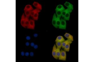 AQP2 Mouse Monoclonal Antibody staining Hela cells by IF/ICC.