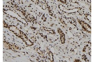 ABIN6273186 at 1/100 staining Human kidney tissue by IHC-P. (WDR46 anticorps  (Internal Region))