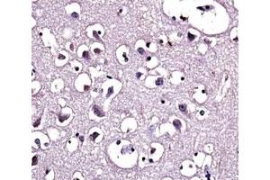 LPL antibody immunohistochemistry analysis in formalin fixed and paraffin embedded human brain tissue. (Lipoprotein Lipase anticorps  (AA 300-327))
